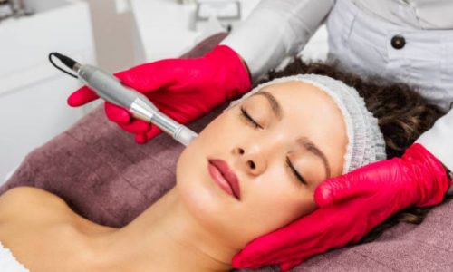 Microneedling with PRP Duluth
